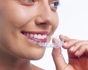 Invisalign, die unsichtbare Zahnspange